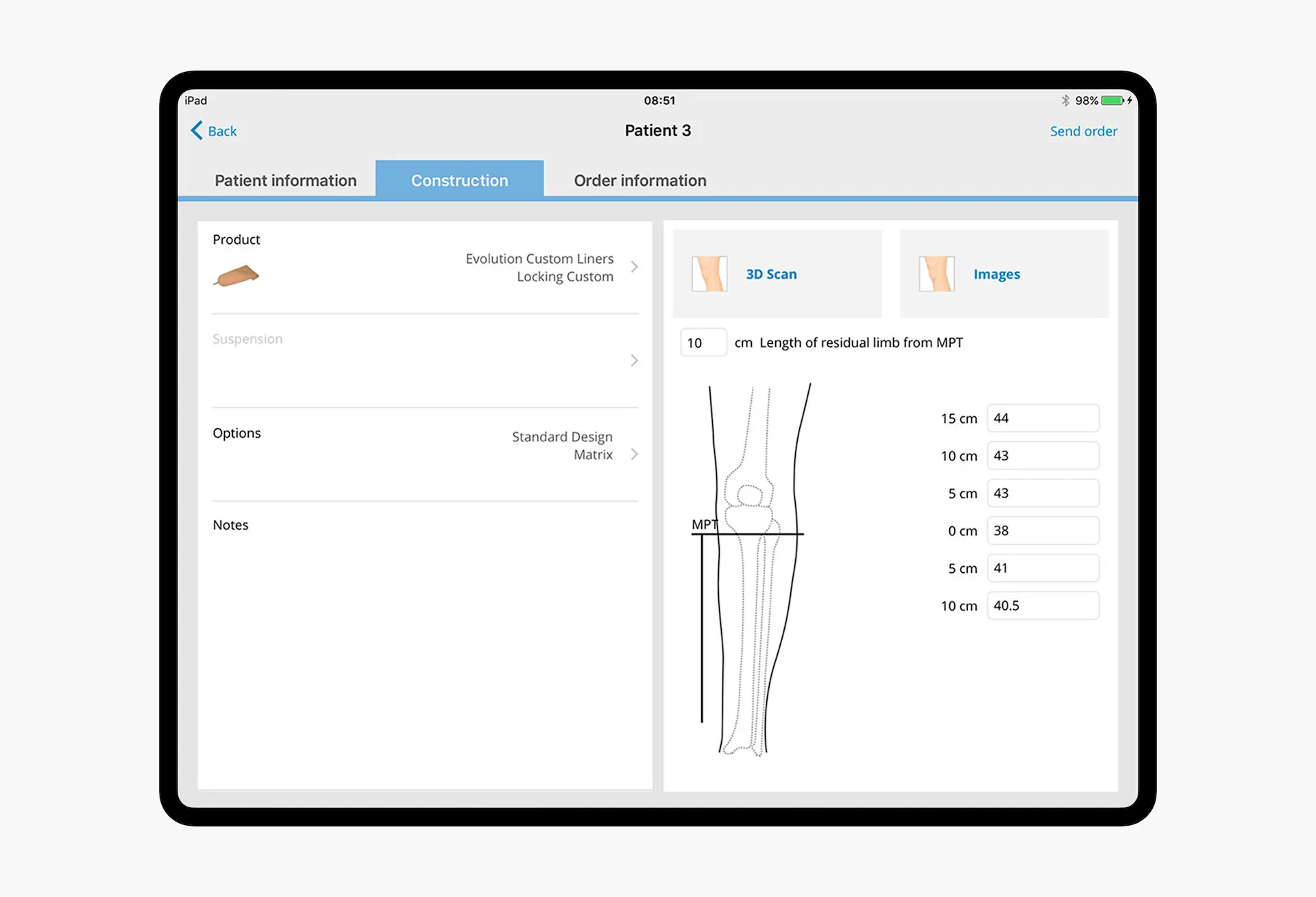 Össur-custom-prosthetic-ordering